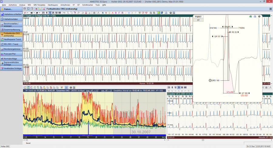 ECGpro — Analyse Holter