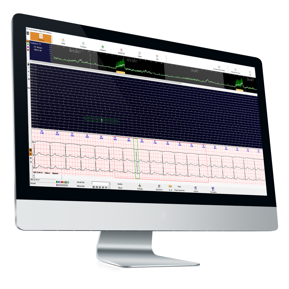 CardioScan 10 / 11 / 12 — visuel CardioScan / DMS